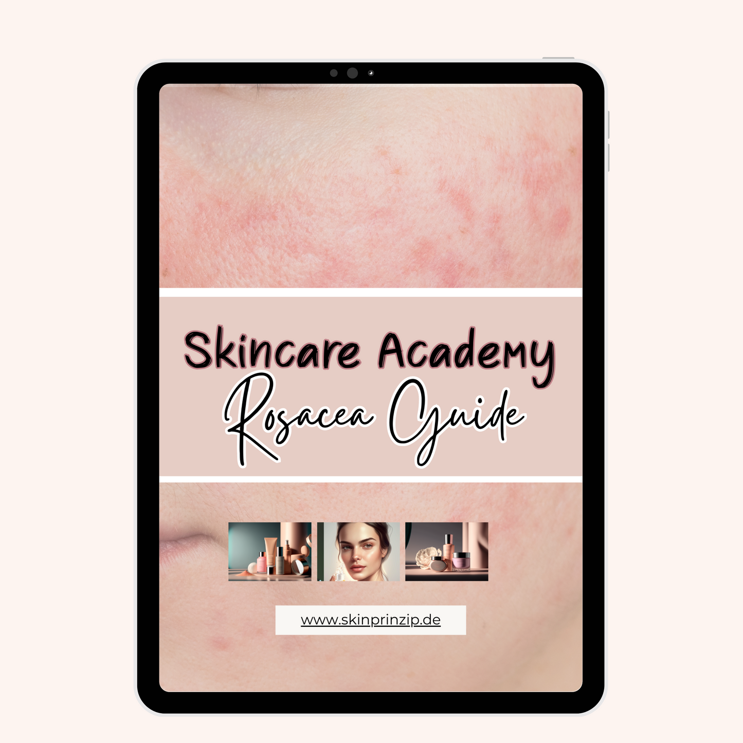 Rosacea Guide- Skincare Academy
