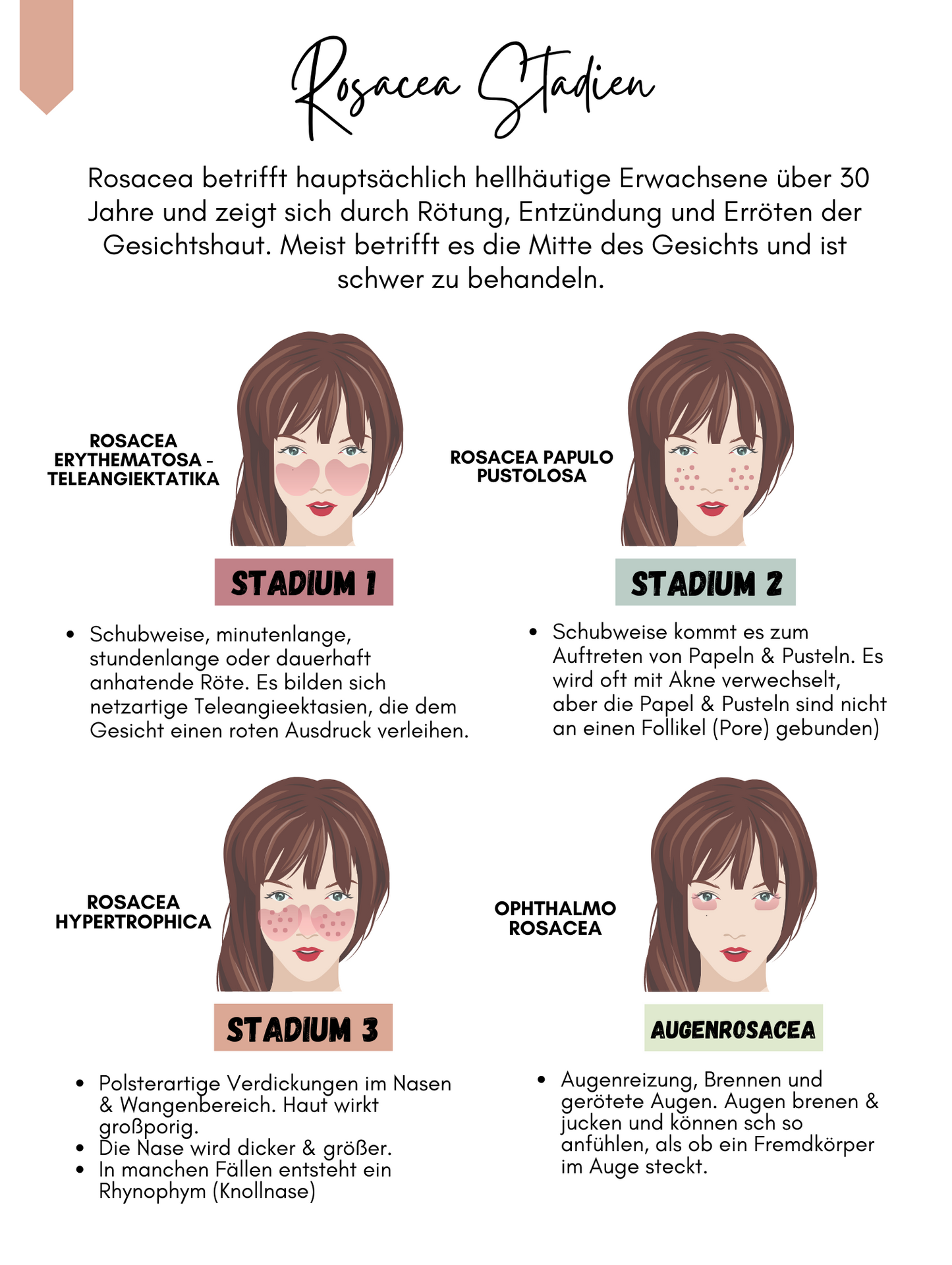 Rosacea Guide- Skincare Academy