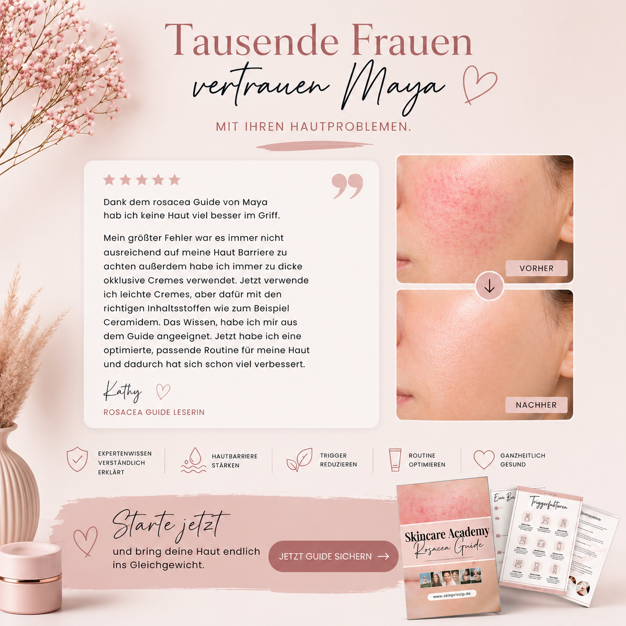 Rosacea Guide by Skinprinzip