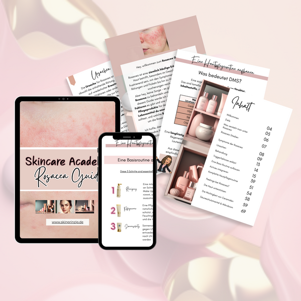 Rosacea Guide- Skincare Academy