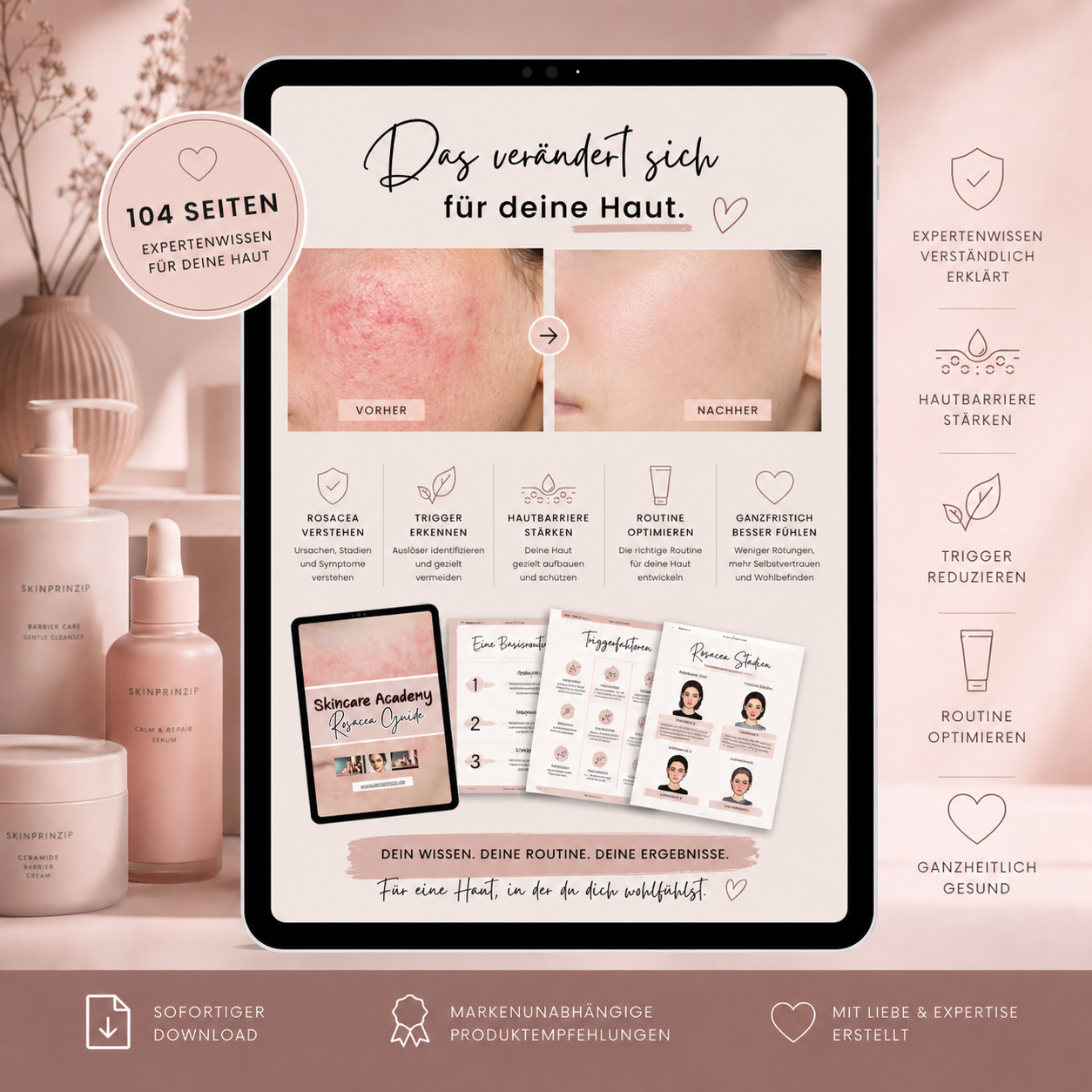 Rosacea Guide by Skinprinzip